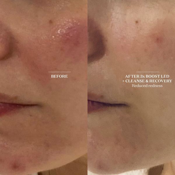 Косметичний засіб The Light Salon Cleanse and Recovery Spray, 101 мл КОСМ00373 фото
