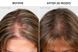 Hairmax PowerFlex Laser 272 Cap &mdash; лазерна кепка для росту волосся HM-1012 фото 3