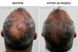 Hairmax PowerFlex Laser 272 Cap &mdash; лазерна кепка для росту волосся HM-1012 фото 2