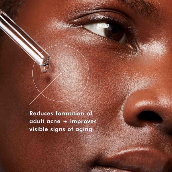 Косметичний засіб SkinCeuticals Blemish + Age Defense, 30 мл КОСМ01224 фото