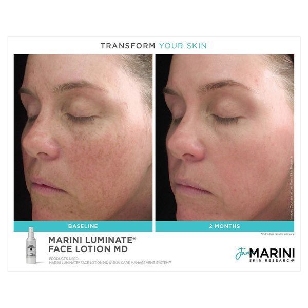 Косметичний засіб Jan Marini Marini Luminate Face Lotion, 30 мл КОСМ01474 фото
