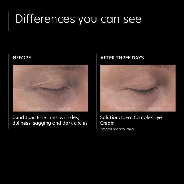 Косметичний засіб PCA Skin Ideal Complex Restorative Eye Cream, 15 мл КОСМ02124 фото