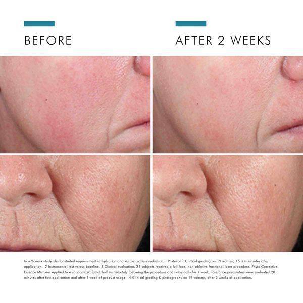 Косметичний засіб SkinCeuticals Phyto Corrective Essence Mist, 50 мл КОСМ01425 фото