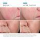 Косметичний засіб SkinCeuticals Phyto Corrective Essence Mist, 50 мл КОСМ01425 фото 2