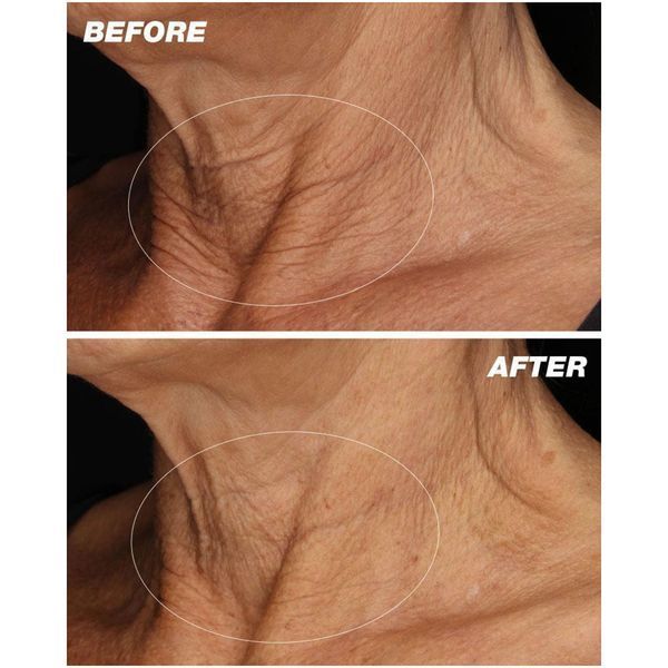 Косметичний засіб Dermalogica Neck Fit Contour Serum, 50 мл КОСМ06126 фото