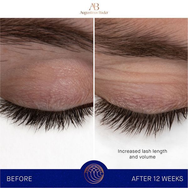 Косметичний засіб Augustinus Bader The Eyebrow and Lash Enhancing Serum, 8 мл КОСМ02126 фото