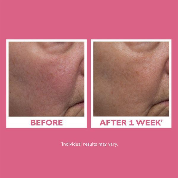 Косметичний засіб Peter Thomas Roth Vital-E Microbiome Age Defense Cream, 50 мл КОСМ06127 фото
