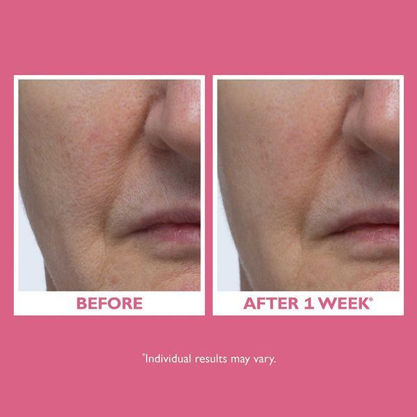Косметичний засіб Peter Thomas Roth Vital-E Microbiome Age Defense Cream, 50 мл КОСМ06127 фото