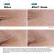Косметичний засіб SkinCeuticals P-TIOX, 30 мл КОСМ00977 фото 2