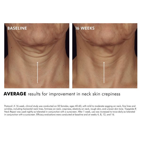 Косметичний засіб SkinCeuticals Tripeptide-R Neck Repair, 50 мл КОСМ01228 фото