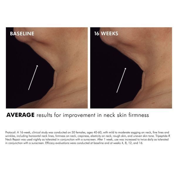 Косметичний засіб SkinCeuticals Tripeptide-R Neck Repair, 50 мл КОСМ01228 фото