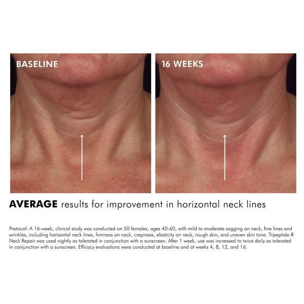 Косметичний засіб SkinCeuticals Tripeptide-R Neck Repair, 50 мл КОСМ01228 фото