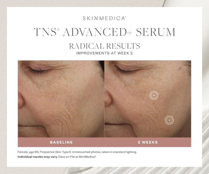 Косметичний засіб SkinMedica TNS Advanced+ Serum, 30 мл КОСМ00928 фото