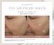 Косметичний засіб SkinMedica TNS Advanced+ Serum, 30 мл КОСМ00928 фото 5