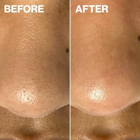 Косметичний засіб Dermaflash Dermapore+ Blush, 207 мл КОСМ05229 фото