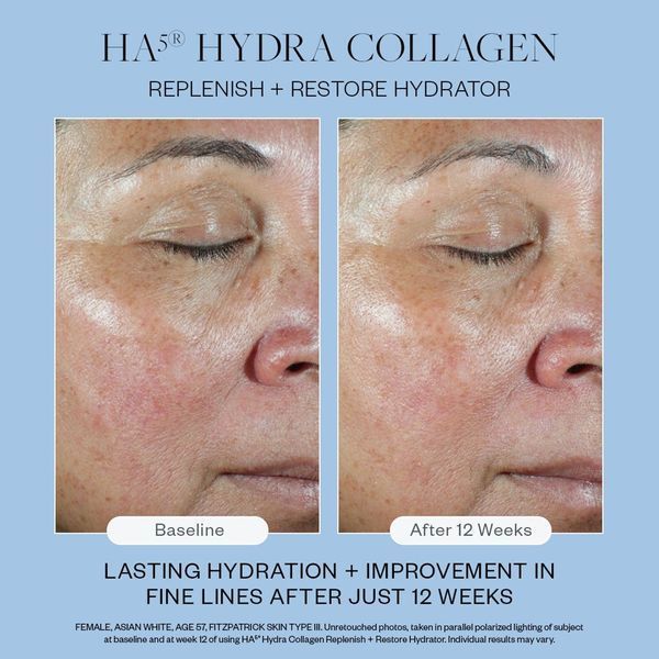 Косметичний засіб SkinMedica HA⁵ Hydra-Collagen Replenish + Restore Hydrator, 59 мл КОСМ01629 фото