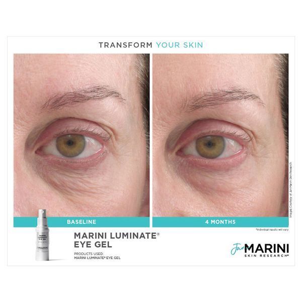 Косметичний засіб Jan Marini Marini Luminate Eye Gel, 15 мл КОСМ02129 фото