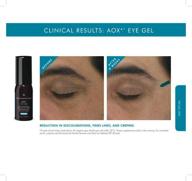 Косметичний засіб SkinCeuticals Aox+ Eye Gel, 15 мл КОСМ00729 фото