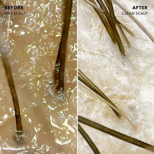 Косметичний засіб Sunday II Sunday Root Refresh Micellar Rinse, 240 мл КОСМ02744 фото