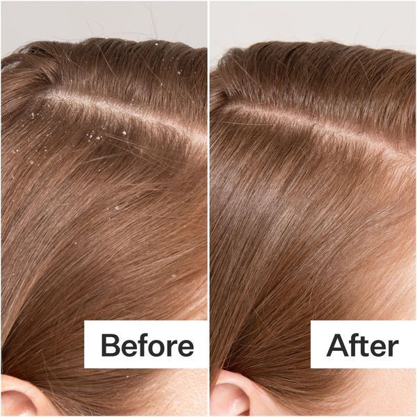 Косметичний засіб Act+Acre Cold Processed Scalp Detox, 89 мл КОСМ03080 фото