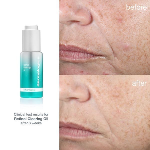 Косметичний засіб Dermalogica Retinol Clearing Oil, 30 мл КОСМ00780 фото