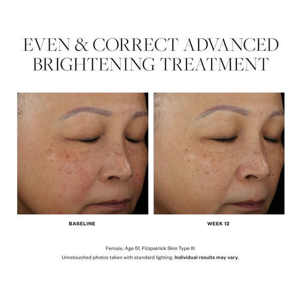 Косметичний засіб SkinMedica Even & Correct Advanced Brightening Treatment, 59 мл КОСМ00580 фото