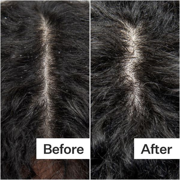 Косметичний засіб Act+Acre Cold Processed Scalp Detox, 89 мл КОСМ03080 фото
