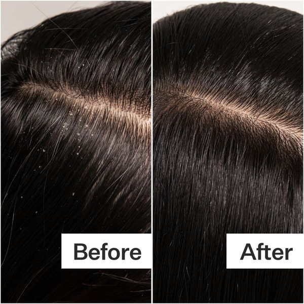 Косметичний засіб Act+Acre Cold Processed Scalp Detox, 89 мл КОСМ03080 фото
