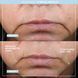 Гель-провідник для мікрострумів NuFACE Aqua Gel Activator КОСМ04830 фото 4