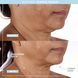 Гель-провідник для мікрострумів NuFACE Aqua Gel Activator КОСМ04830 фото 3