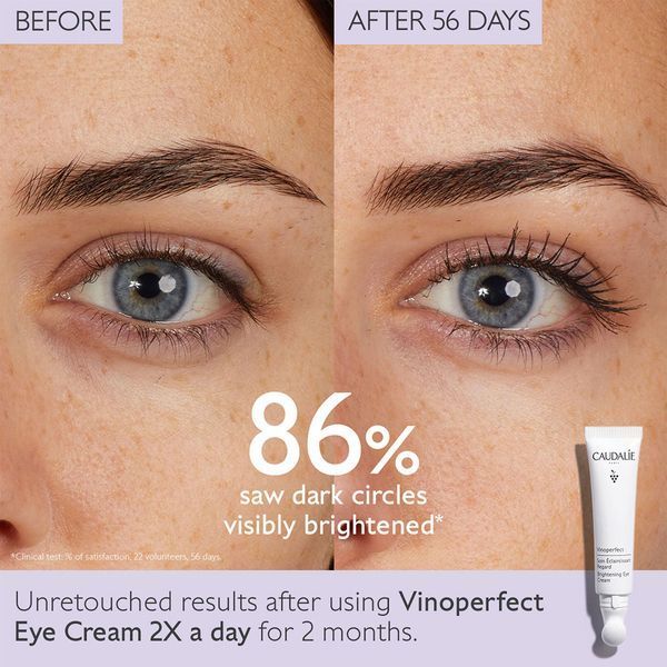 Косметичний засіб Caudalie Vinoperfect Dark Circle Brightening Eye Cream, 15 мл КОСМ02131 фото