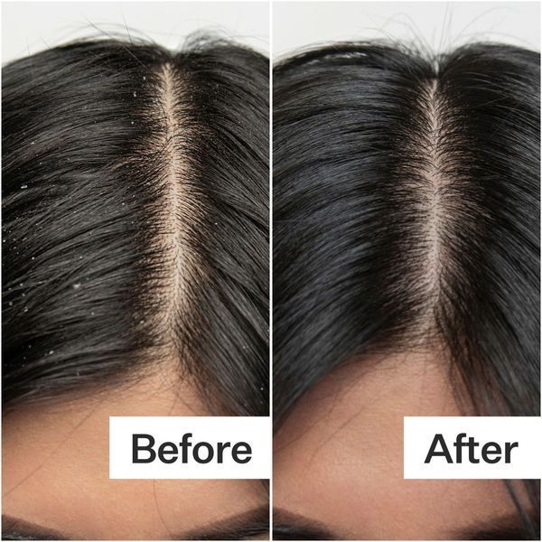 Косметичний засіб Act+Acre Salicylic Acid Scalp Exfoliator, 59 мл КОСМ03181 фото