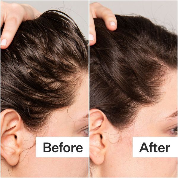Косметичний засіб Act+Acre Salicylic Acid Scalp Exfoliator, 59 мл КОСМ03181 фото
