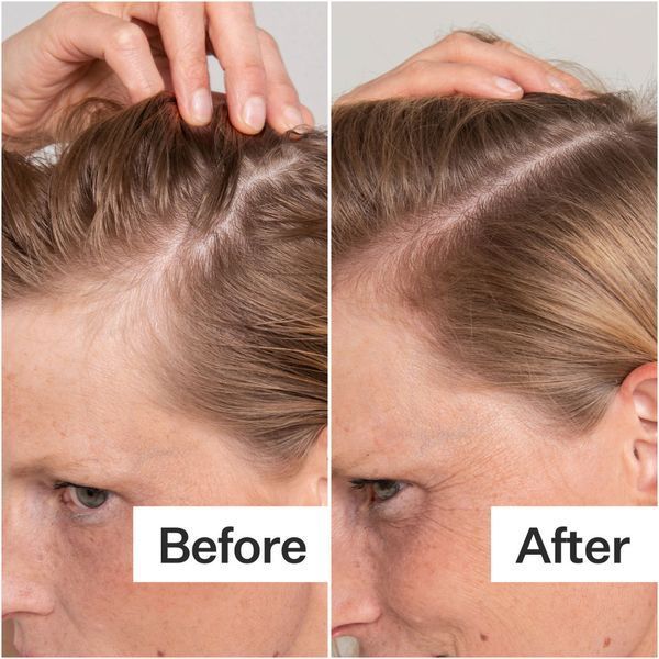 Косметичний засіб Act+Acre Salicylic Acid Scalp Exfoliator, 59 мл КОСМ03181 фото