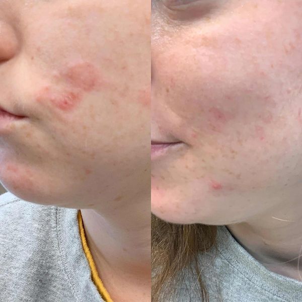 Косметичний засіб BalmLabs ClearBalm Serum Hydrator, 30 мл КОСМ00984 фото