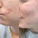 Косметичний засіб BalmLabs ClearBalm Serum Hydrator, 30 мл КОСМ00984 фото 4