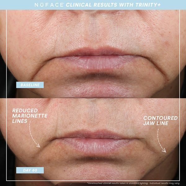 Мікрострумовий ліфтинг-пристрій NuFACE Trinity+ з насадкою Effective Lip & Eye КОСМ02386 фото