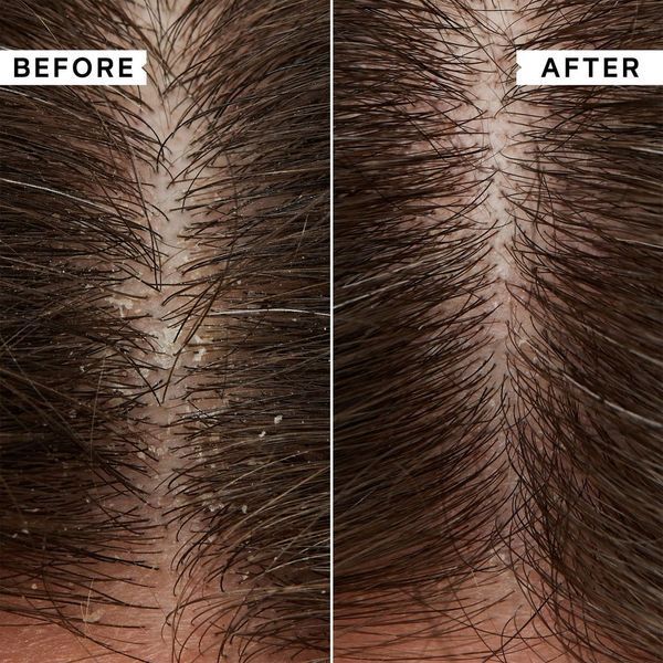Косметичний засіб Philip Kingsley Flaky Scalp Calming Toner, 250 мл КОСМ03086 фото