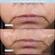 Мікрострумовий ліфтинг-пристрій NuFACE Trinity+ з насадкою Effective Lip & Eye КОСМ02386 фото 2