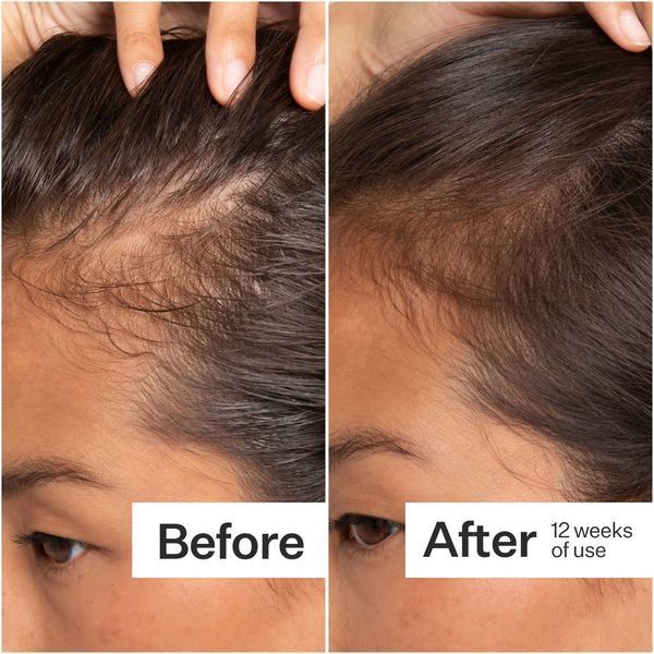 Косметичний засіб Act+Acre Cold Processed Stem Cell Serum, 65 мл КОСМ03087 фото