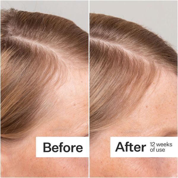 Косметичний засіб Act+Acre Cold Processed Stem Cell Serum, 65 мл КОСМ03087 фото