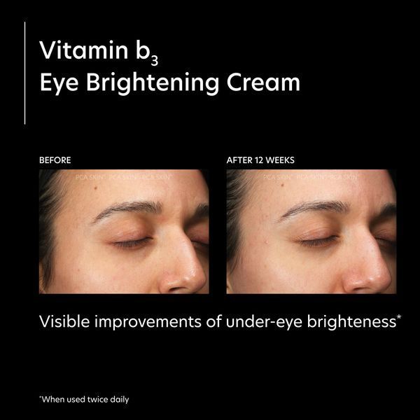 Косметичний засіб PCA Skin Vitamin B3 Eye Brightening Cream, 14 мл КОСМ02038 фото