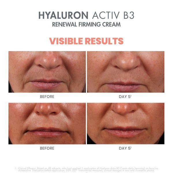 Косметичний засіб Av&egrave;ne Hyaluron Activ B3 Renewal Firming Cream, 47 мл КОСМ01638 фото