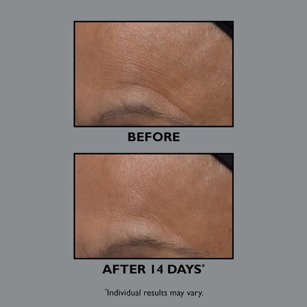 Зволожувальний крем Peter Thomas Roth FIRMx Collagen Moisturizer, 50 мл КОСМ01145 фото