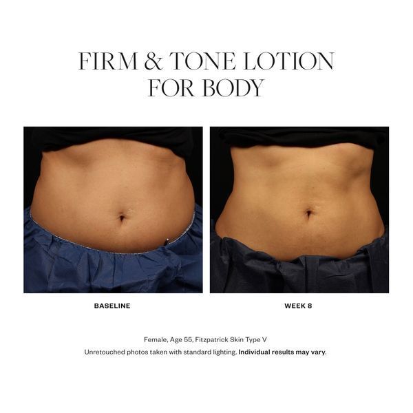 Косметичний засіб SkinMedica Firm & Tone Lotion For Body, 177 мл КОСМ03595 фото
