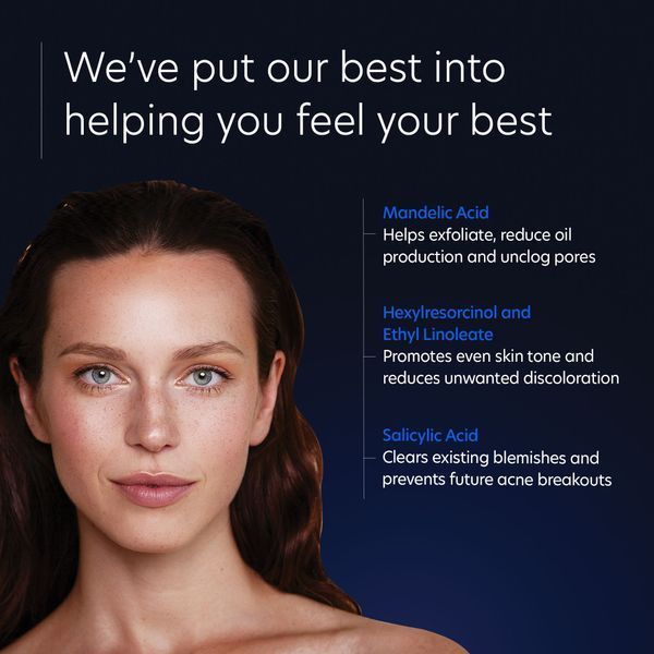 Косметичний засіб PCA Skin Acne Gel With OmniSome, 30 мл КОСМ00845 фото