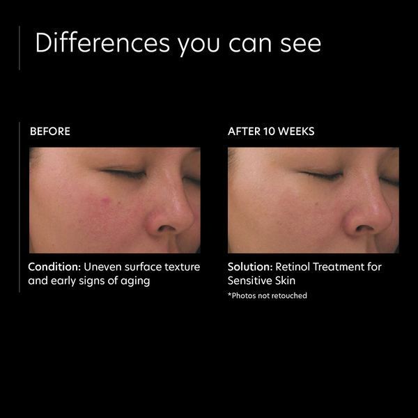 Косметичний засіб PCA Skin Retinol Treatment for Sensitive Skin, 30 мл КОСМ00840 фото