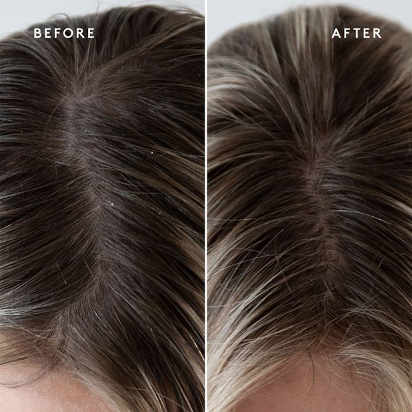 Косметичний засіб Virtue Refresh Exfoliating Scalp Treatment, 148 мл КОСМ03096 фото