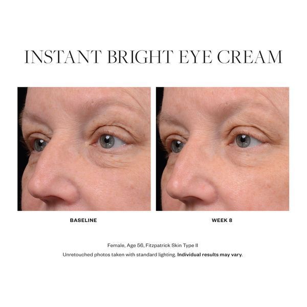Косметичний засіб SkinMedica Instant Bright Eye Cream, 15 мл КОСМ02047 фото