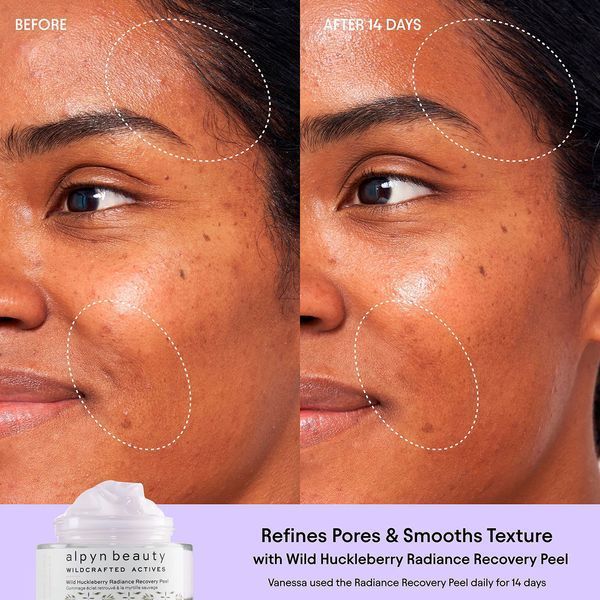Косметичний засіб Alpyn Beauty Wild Huckleberry Radiance Recovery Peel, 50 мл КОСМ01997 фото